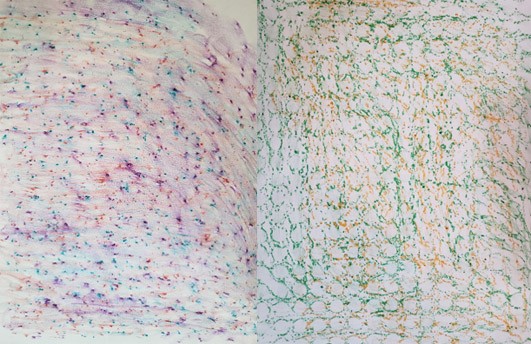 Multi-colored texture rubbings, one bumpy and one with defined circles.
